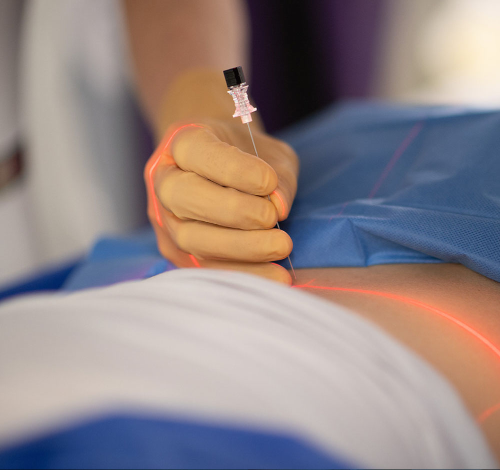 arthroscanner